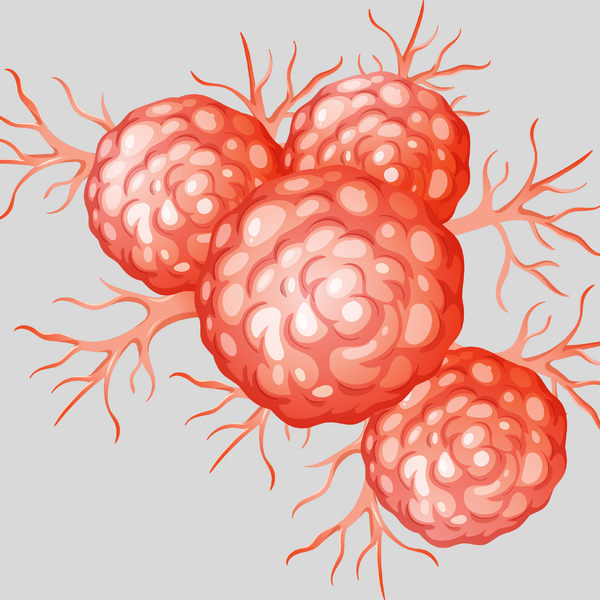 File:Tumor Seeding.png